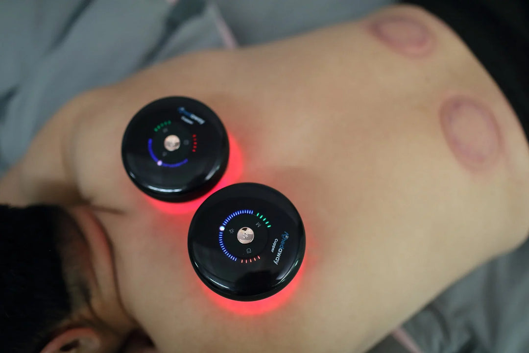 Achedaway Cupper 智慧型拔罐療法按摩器